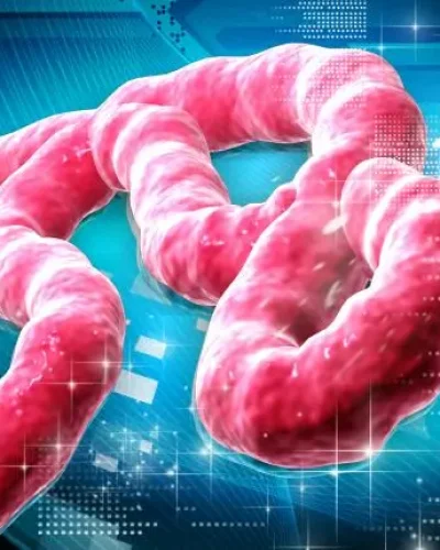 Ebola