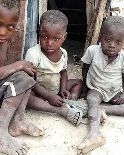 Starving children (Photo Credit: Love A Child)